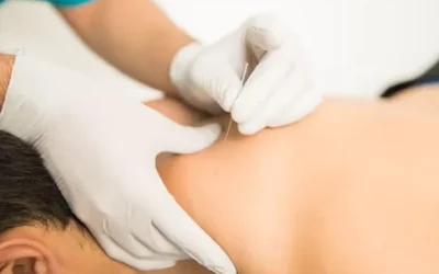 Dry Needling at Activecare Physical Therapy: 4 Health Benefits You Need to Know Writer: Ehren Trost